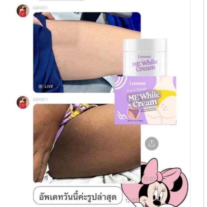 ครีมทาง่ามขาแอนนา-โลชั่นโสมกลูต้า-ของแท้-กระปุกสกรีน-มีโค้ดด้านในกล่อง