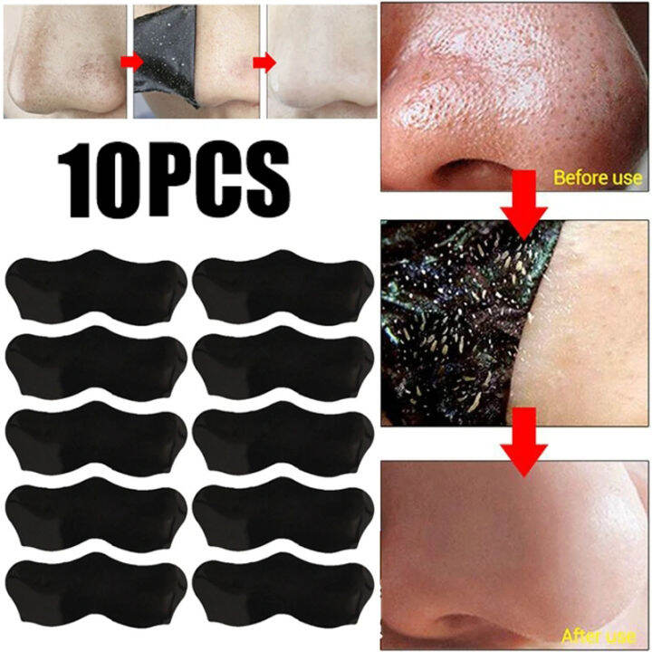 White Black Blackhead Remove Mask Shrink Pore Nose Cleansing Stickers ...