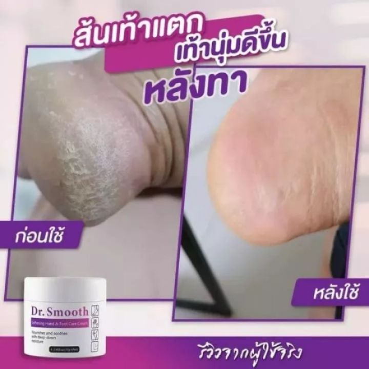 ยิ่งคัน-ยิ่งเกา-แนะนำๆ-dr-smooth-ดร-สมูท-ครีมทา-ดูแลปัญหา-ผด-ผื่น-ตุ่มแดง-ตุ่มใส-อาการคัน-ยิ่งเกายิ่งลาม-ขนาด-1-กระปุก