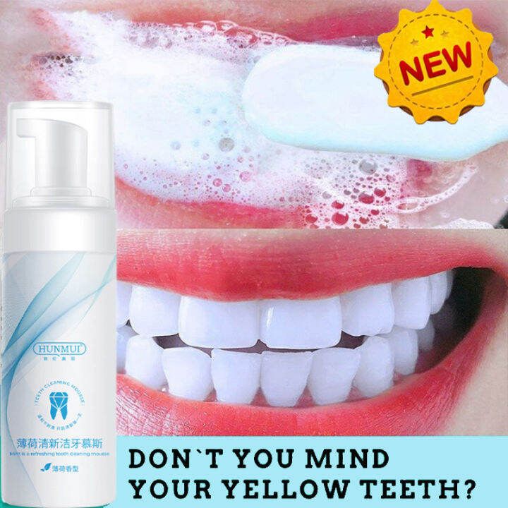 Teeth Mousse Whitening Removes Stains Yellowing And Halitosis Removing ...