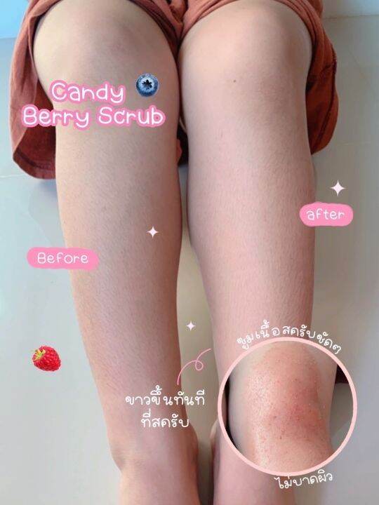 สครับผิวกลิ่นหอมเบอร์รี่-chume-candy-berry-scrub-ลดรอยดำคล้ำ-ผิวเนียน-ลดขนคุด-เนื้อนุ่มเนียนละเอียดไม่บาดผิว