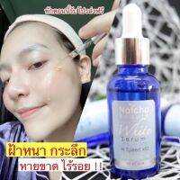 [พร้อมส่ง ของแท้?]​ ถูก​กว่านี้​ระวัง‼️ของปลอม​ เซรั่ม​ณัชชา​ ลดสิว ฝ้า กระ หายขาด มีบัตร​ ส่งไว​