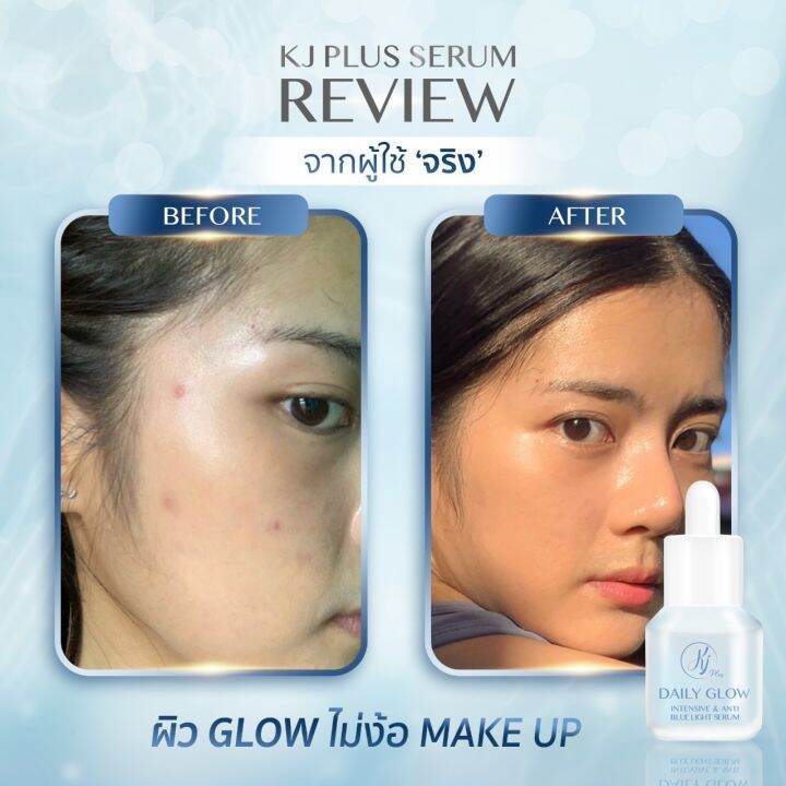 kj-plus-serum-ป้องกันแสงสีฟ้า