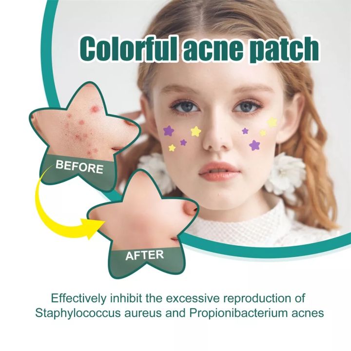 eelhoe-colorful-acne-patch-แผ่นแปะสิว-112-ชิ้น