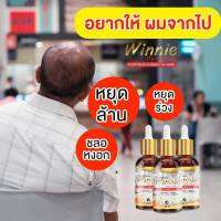 วินนี้แฮร์เซรั่ม ลดผมร่วง ปลูกผมใหม่