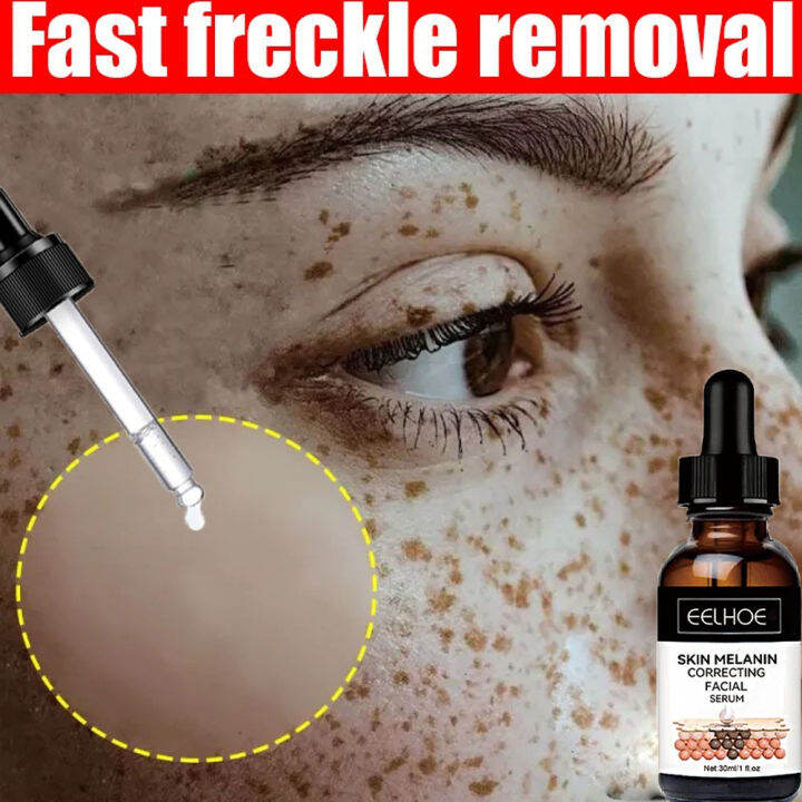 Vitamin C Anti Freckle Whitening Serum Niacinamide Remove Age Dark