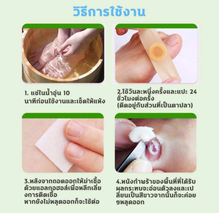 แผ่นแปะตาปลา-แผ่นแปะหูด-พลาสเตอร์ลอกตาปลา-พลาสเตอร์ลอกหูด