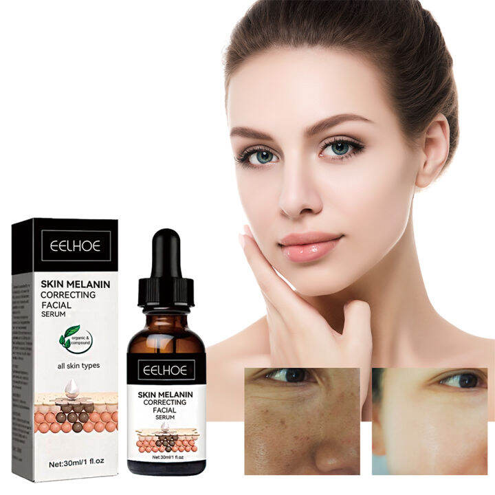 Melasma Whitening Serum Freckle Essence Oil Dark Spot Corrector ...