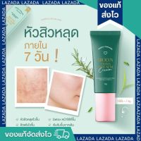 ?ละลายสิว ละลายสิวไบโอลิน ลดสิวอุดตัน ครีมละลายสิว | Yerpall Biolyn anti acne free