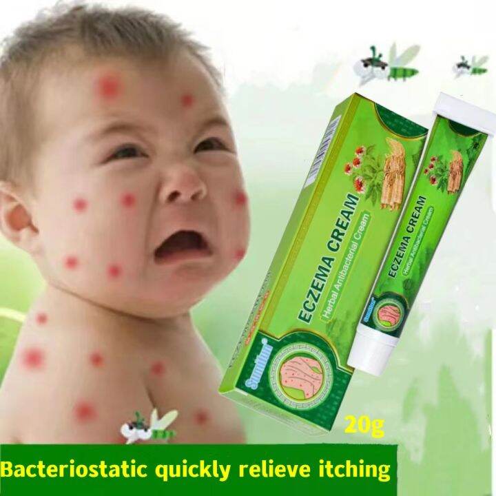 Effective Sumifun Eczema Treatment Cream gamot sa kati kati sa balat
