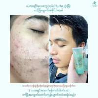 I Aura Collagen Gel