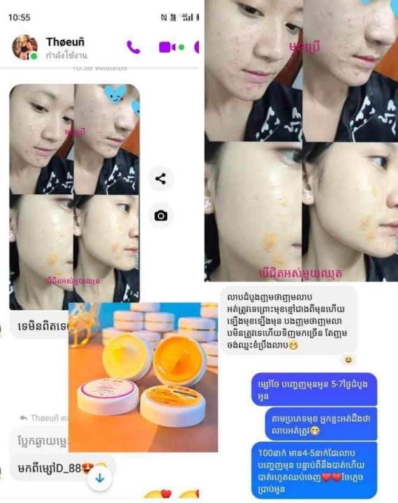 ครีม-บำรุงผิวหน้าd88-แก้ฝ้าแกสิวรอยดำ