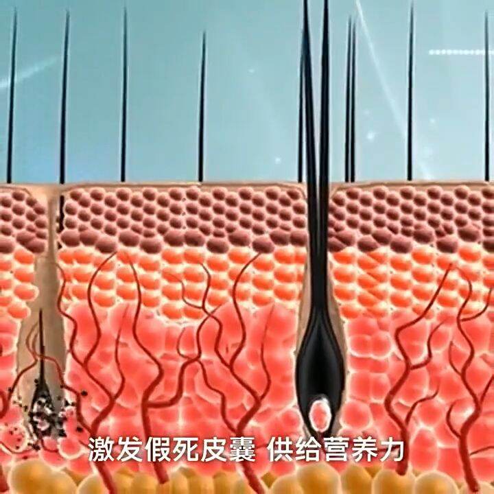 ZHENXIU Ginger Shampoo Promotes Hair Growth Thicker Antidandruff anti