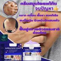 ? Herbal Tinea Anti ?ครีมแก้คัน 30g ก้กลาก สะเก็ดเงิน สูตรสมุนไพรธรรมชาติ 100% ซ่อมแซมความเสียหาย เพิ่มน้ำมันทีทรีโพลิส itching cream