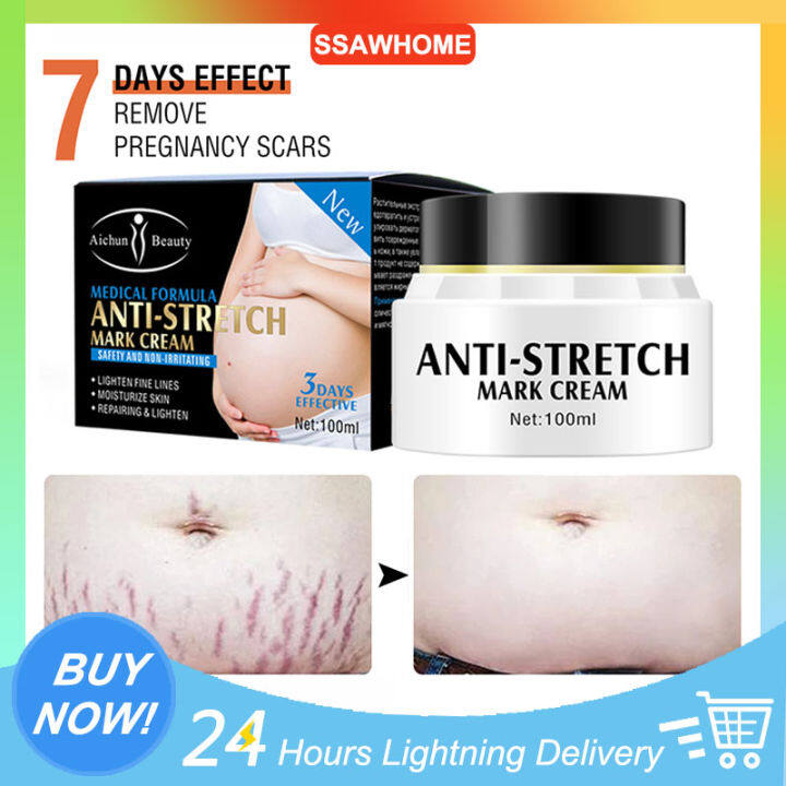 100g Remove Stretch Marks And Scars Cream Remove Pregnancy Scars Of ...