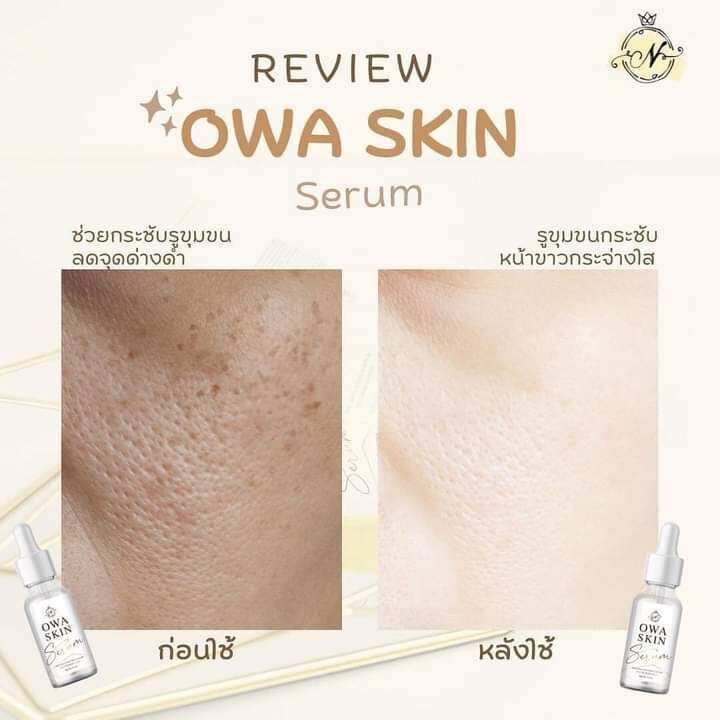 owa-skin-serum-เซรั่มไฮยารูลอน