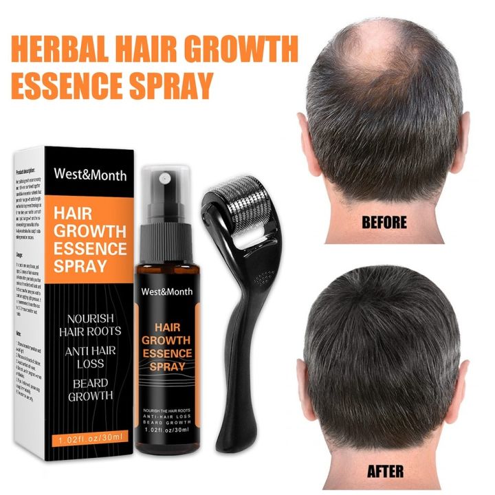 ORIGINAL West&Month Hair Growth Essence Spray (30ml) Nourish Hair Roots ...