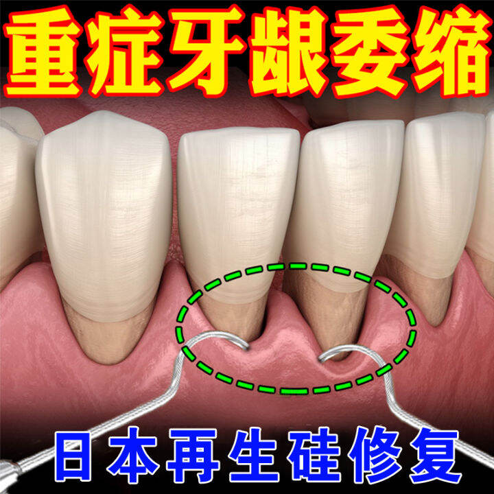 [Japanese Technology] Gum Abscess Bleeding and Atrophy Repair