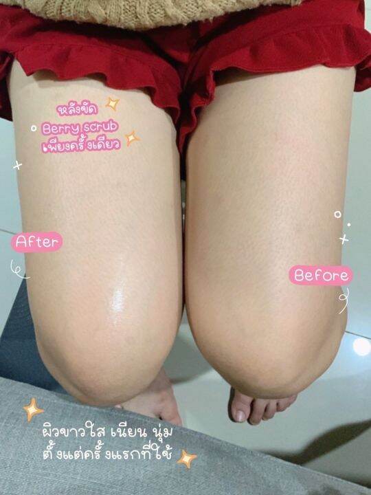 สครับผิวกลิ่นหอมเบอร์รี่-chume-candy-berry-scrub-ลดรอยดำคล้ำ-ผิวเนียน-ลดขนคุด-เนื้อนุ่มเนียนละเอียดไม่บาดผิว