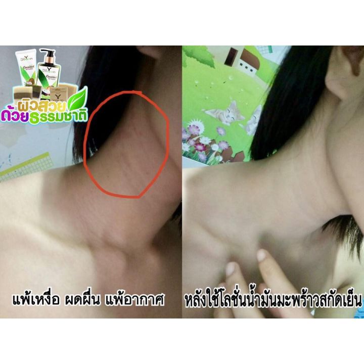 โลชั่นน้ำมันมะพร้าวสะกัดเย็น-โลชั่นยางนา