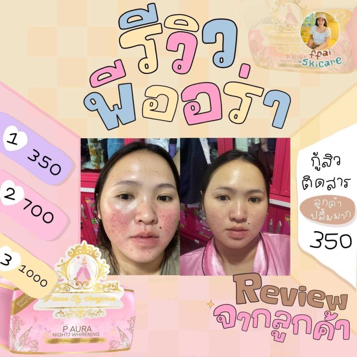 ครีมพีออร่าไนท์-ครีมหน้าใสลดสิว-ของแท้