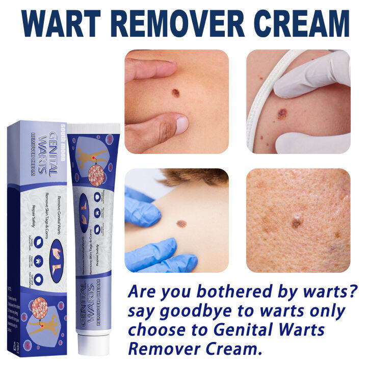 Warts Remover Original Cream Wart Removal Ointment Wart Treatment Skin