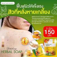 สมุนไพร พรทิน่า 300 g 150฿ ชื้อ2 ฟรี3 ก้อน ของแท้%