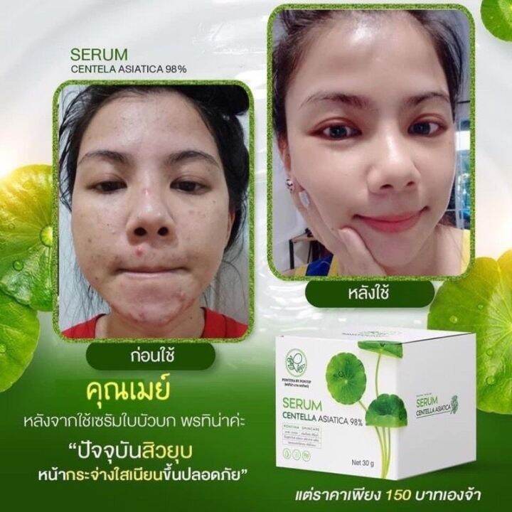 เซรั่มใบบัวบก-amp-สบู่ใบบัวบก