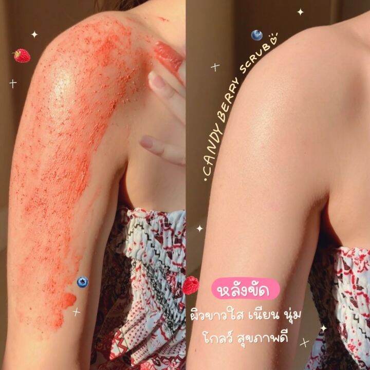 สครับผิวกลิ่นหอมเบอร์รี่-chume-candy-berry-scrub-ลดรอยดำคล้ำ-ผิวเนียน-ลดขนคุด-เนื้อนุ่มเนียนละเอียดไม่บาดผิว