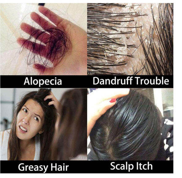 Ginger Juice Hair Growth Shampoo 300ml anti hair fall dense hair