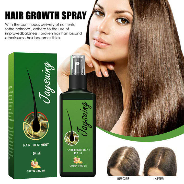 Pastsky ginger hair growth spray hair growth Oil hair regrowth serum ...