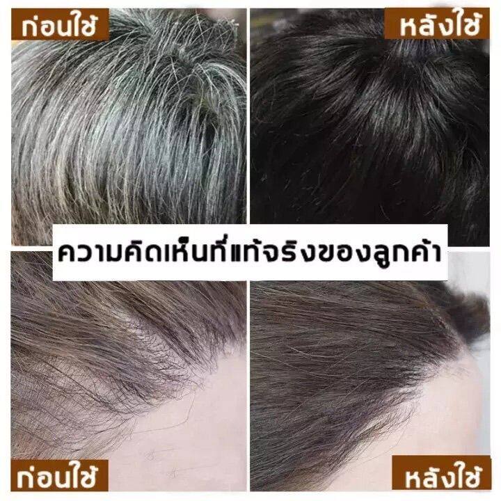 แชมพูปิดผมหงอก-300ml-ผมเงาดำ-ยาสระแก้ผมหงอก-แชมพูแก้ผมหงอก