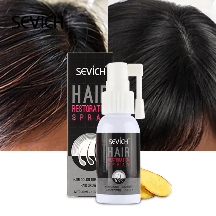 FancyBeauty* Grey Hair Treatment Serum Hair Growth Spray Restoration Black Hair Anti Hair Loss White Hair Repair Hair Loss Product | Lazada PH FancyBeauty* Grey Hair Treatment Serum Hair Growth Spray Restoration Black Hair Anti Hair Loss White Hair Repair Hair Loss Product | Lazada PH