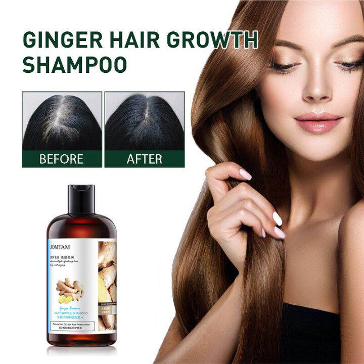 Anti-Hair Loss Ginger Shampoo Hair growth Herbal Shampoo 400ml Anti ...