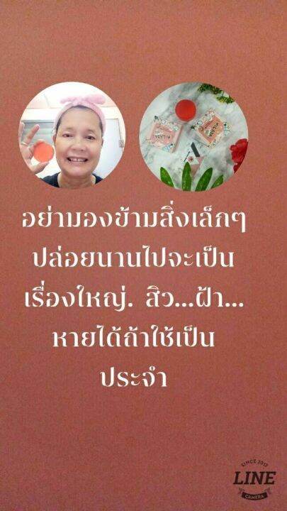 สบู่คลีนซิ่งมิลาด้า-ประกอบด้วย-7-ส่วนผสม-อุดมไปด้วยคุณค่า-1-ว่านหางจรเข้-ช่วยรักษาสิว-รอยดำ-2-น้ำมันมะพร้าว-ทำให้ผิว-ชุ่มชื่น-ดูอ่อนไว-3-พิเทร่า-ช่วยให้รูขุมขนกระชับ-ดูเล็กลง-4-แตงกวา-เติมน้ำให้ผิวดูอ