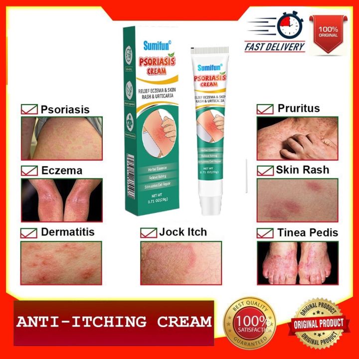 Eczema Cream Skin Psoriasis Cream Dermatitis Eczematoid Anti Eczema 