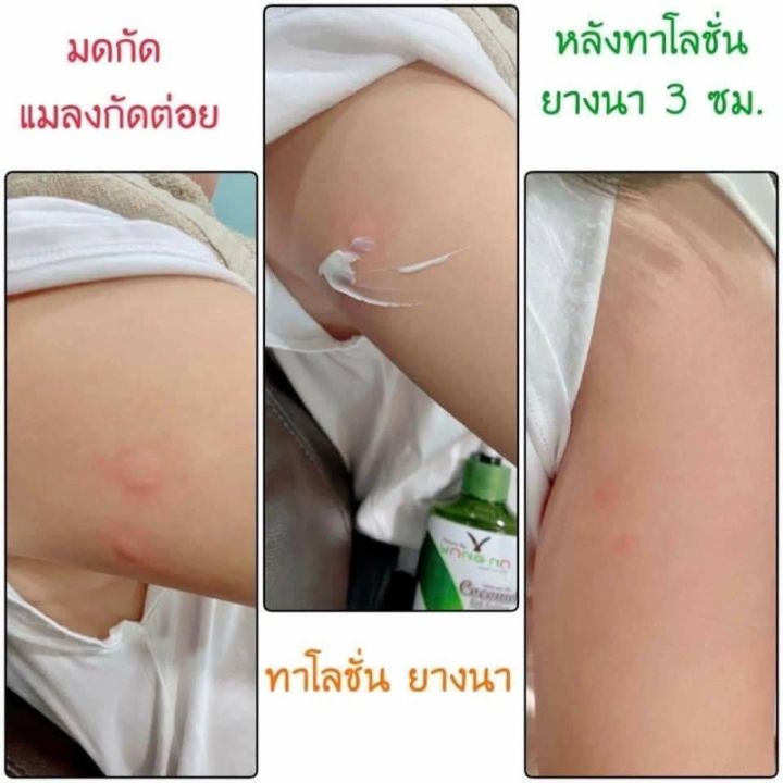 โลชั่นยางนา-โลชั่นน้ำมันมะพร้าวสะกัดเย็น