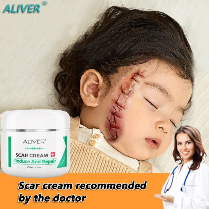 ELAIMEI scar cream Acne Scar Removal Cream stretch mark remover Acne