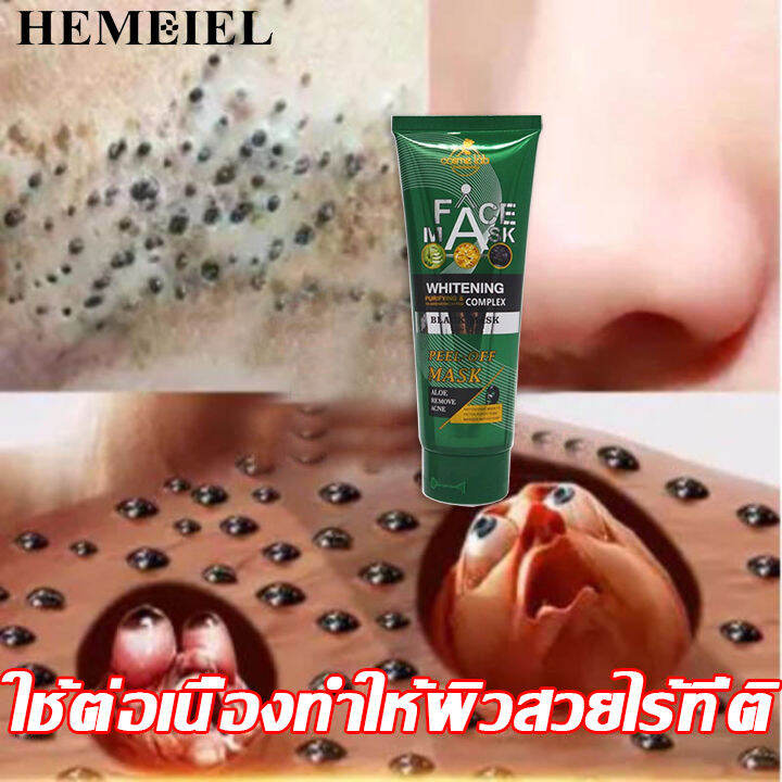 hemeiel-แผ่นลอกสิวเสี้ยน-กำจัดสิวเสี้ยน-ขัดสิวเสี้ยน-นุ่มและขจัดสิวหัวดำ