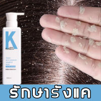 จัดส่งทันที แชมพูสระผม OuSHLIAN แชมพูแก้รังแค แชมพูควบคุมความมัน 500ml แชมพูขจัดรังแค แชมพูแก้คันศรีษะ แชมพูแก้เชื้อรา เซ็บเดิร์มและราบนศีรษะ น้ำยาขจัดรังแค บำรุงรากผม ป้องกันผมร่วง รังแค dandruff shampoo แชมพูสมุนไพร