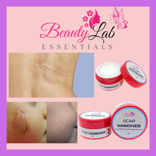 PINOY WELLNESS Scar Removal Cream (10g) Beauty Essentials Scar