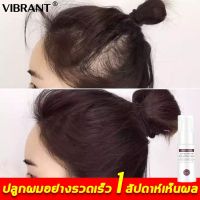 ?สินค้าขายดี? GLAMOUR น้ำยาปลูกผม 30ML เพิ่มความหนาแน่นของเส้นผม ปรับปรุงผมร่วง,สเปรย์ปลูกผม เซรั่มปลูกผม ยาปลูกผมของแท้ น้ำยาใส่ผม