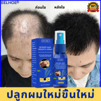 ?บอกลาหัวล้าน?EELHOE สเปรย์ปลูกผม น้ำยาปลูกผม เร่งผมขึ้นใหม่ ป้องกันผมร่วง ป้องกันผมร่วงอย่างมืออาชีพ แก้ปัญหาผมร่วง ลดผมร่วง（ปลูกผมเร่งด่วน ยาปลูกผมของแท้ บำรุงผม เซรั่มปลุกผม น้ำยาเร่งผมยาว เซรั่มปลูกผม สเปรย์ปปลูกผม ยาปลูกผม นํ้ายาปลูกผม）Hair Growth