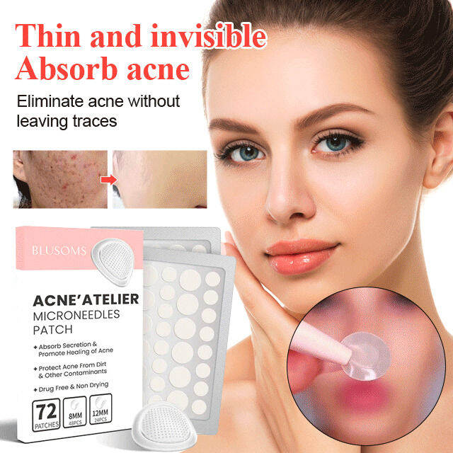 SCUC. Spots & Blemishes scuc Invisible acne marks removal acne pimple