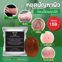 สบู่น้ำมันดิน MR.TAR Soap ก้อนใหญ่ จัมโบ้ ขนาด100 กรัม ก้อนใหญ่ สะเก็ดเงิน เซบเดิร์ม ผิวหนังอักเสบ ผื่นคัน