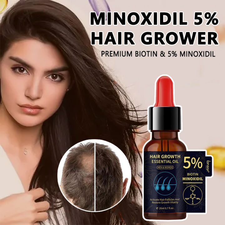 Minoxidil 5% Hair Growth Essential Oil Ginger Hair Nutrient Solution ...
