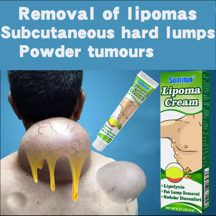 Sumifun Fibroid Ointment Pain Relief Elimination Lipoma Natural Plant