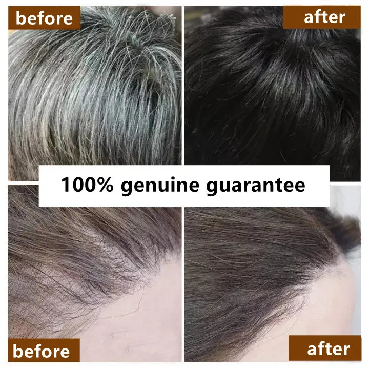 Polygonum multiflorum mild hair care Essence spray Herbal natural extract shampoo efficient save gray hair Anti- Polygonum multiflorum mild hair care Essence spray Herbal natural extract shampoo efficient save gray hair Anti-