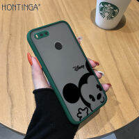 Hontinga เคสมือถือ เคสโทรศัพท์ เคส Xiaomi Mi A1การ์ตูนน่ารักเมาส์มีน้ำค้างแข็งโปร่งใสเคสโทรศัพท์เต็มรูปแบบเคสโทรศัพท์เลนส์ตัวปกป้องกล้องถ่ายรูปกรณี Hard