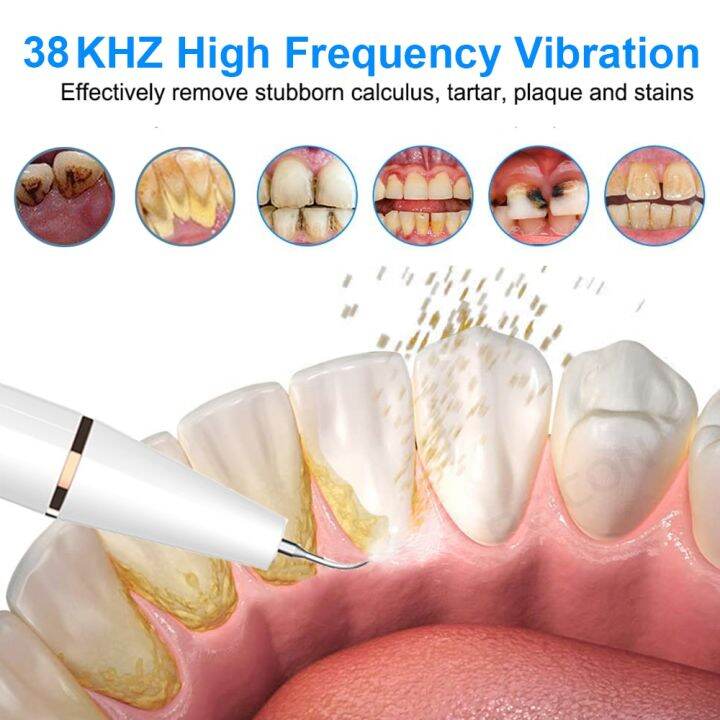 cw-ultrasonic-scaler-teeth-tartar-stain-calculus-remover-electric-plaque-cleaner-stone-removal